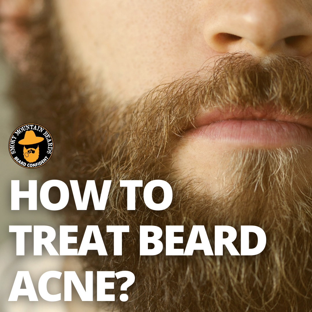 How to Kick Beard Acne to The Curb